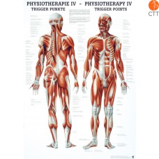 Poster Physiotherapy IV - THE TRIGGER POINTS, 50 x 70cm, German and English, paper with fine metal bars