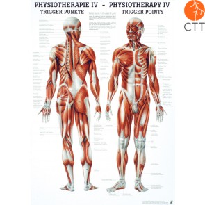 Poster Physiotherapie IV - DIE TRIGGER PUNKTE, 50 x 70cm, deutsch und englisch, Papier mit feinen Metalleisten